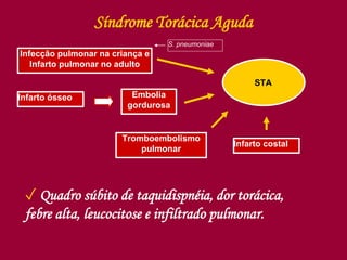 Síndrome Torácica Aguda
Infecção pulmonar na criança e
Infarto pulmonar no adulto
Infarto ósseo Embolia
gordurosa
Tromboembolismo
pulmonar
Infarto costal
STA
✓ Quadro súbito de taquidispnéia, dor torácica,
febre alta, leucocitose e infiltrado pulmonar.
S. pneumoniae
 