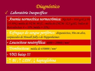 Diagnóstico
✓ Laboratório Inespecífico:
- Anemia normocítica normocrômica: Hg (6,0 – 10,0 g/dL); Ht
(18 30%); média do VCM: 90 fL ; média do CHCM: 32,5 g/dL; Índice de
Reticulócitos: 4 – 10% (média = 10%).
- Esfregaço do sangue periférico: drepanócitos, Hm em alvo,
corpúsculos de Howell-Jolly e de Pappenheimer.
- Leucocitose neutrofílica: 6000 – 20000 / mm³
- Trombocitose: média de 450000 / mm³
- VHS baixo !!!
- ↑ BI ; ↑ LDH ; ↓ haptoglobina
 