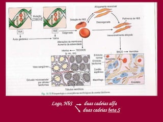 Logo, HbS duas cadeias alfa
duas cadeias beta S
 