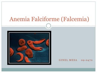 Anemia Falciforme (Falcemia)




                 GINEL MESA   09-0470
 
