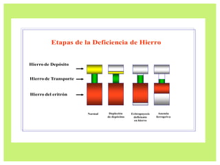 Normal Depleción
de depósitos
Eritropoyesis
deficiente
en hierro
Anemia
ferropriva
Hierro de Depósito
Hierro de Transporte
Hierro del eritrón
Etapas de la Deficiencia de Hierro
 