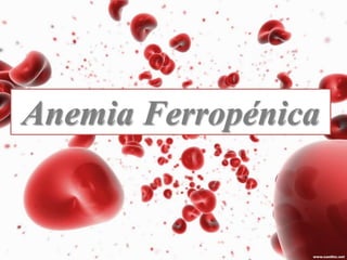 Anemia Ferropénica
 