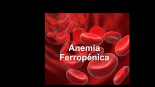 Anemia
Ferropénica
 