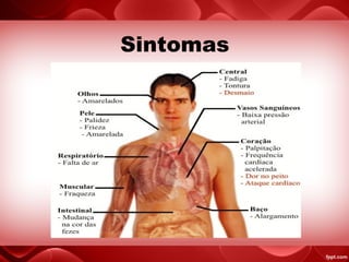 Sintomas
 