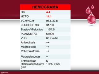 HEMOGRAMA 
HB 4.4 
HCTO 14.1 
VCM/HCM 98,6/30,8 
LEUCOCITOS 31760 
Blastos/Mielocitos 1.0/1.0 
PLAQUETAS 68000 
VHS 60 mm/hr 
Anisocitosis ++ 
Macrocitosis ++ 
Policromatofilia ++ 
Macroplaquetas + 
Eritroblastos 
Reticulocitos/Corre 
gido 
5 1,6%/ 0,5% 
 