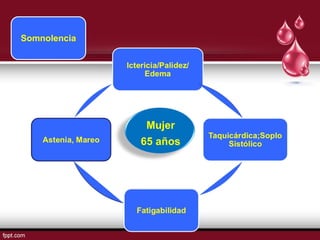 Mujer 
65 años 
Somnolencia 
 