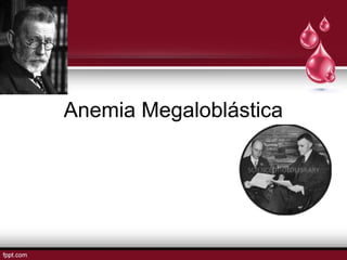 Anemia Megaloblástica 
 