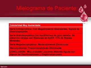 Mielograma de Paciente: 
 