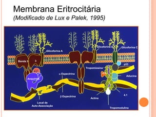 Membrana Eritrocitária
(Modificado de Lux e Palek, 1995)



                                                      Glicoforina A      Glicoforina C
                     Glicoforina A


 Banda 3     3
                                                                          p53
                                               Tropomiosina
            4.2
                               a Espectrina                4.9
                                                                            Aducina
       Anquirina




                                                                          4.1
                                b Espectrina
                                                  Actina
               Local de
           Auto-Associação
                                                                 Tropomodulina
 