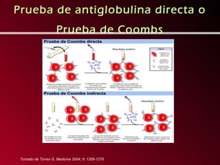 Prueba de antiglobulina directa o
                     Prueba de Coombs




 Tomado de Torres G. Medicine 2004; 9: 1269-1276
 