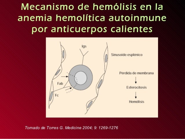 Anemia Hemolitica