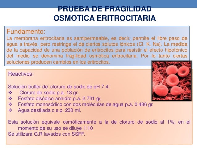 fragilidad osmotica del eritrocito