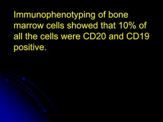Immunophenotyping of bone
marrow cells showed that 10% of
all the cells were CD20 and CD19
positive.
 