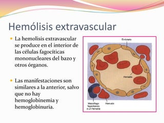 Hemólisis extravascular
 La hemolisis extravascular
se produce en el interior de
las células fagocíticas
mononucleares del bazo y
otros órganos.
 Las manifestaciones son
similares a la anterior, salvo
que no hay
hemoglobinemia y
hemoglobinuria.
 