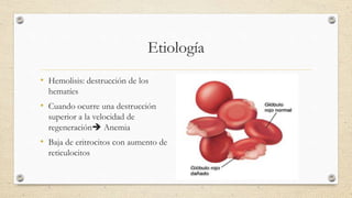 Etiología
• Hemolisis: destrucción de los
hematíes
• Cuando ocurre una destrucción
superior a la velocidad de
regeneración Anemia
• Baja de eritrocitos con aumento de
reticulocitos
 
