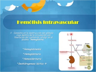 Hemólisis Intravascular
Consiste en la destrucción del glóbulo
rojo dentro de la circulación con
liberación del contenido celular en el
plasma ‘’hemoglobina.’’

*Hemoglobinemia
*Hemoglobinuria
*Hemosiderinuria
*Deshidrogenasa láctica 

 