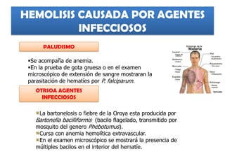 PALUDISMO
HEMOLISIS CAUSADA POR AGENTES
INFECCIOSOS
Se acompaña de anemia.
En la prueba de gota gruesa o en el examen
microscópico de extensión de sangre mostraran la
parasitación de hematíes por P. falciparum.
OTRSOA AGENTES
INFECCIOSOS
La bartonelosis o fiebre de la Oroya esta producida por
Bartonella bacilliformis (bacilo flagelado, transmitido por
mosquito del genero Phebotumus).
Cursa con anemia hemolítica extravascular.
En el examen microscópico se mostrará la presencia de
múltiples bacilos en el interior del hematíe.
 