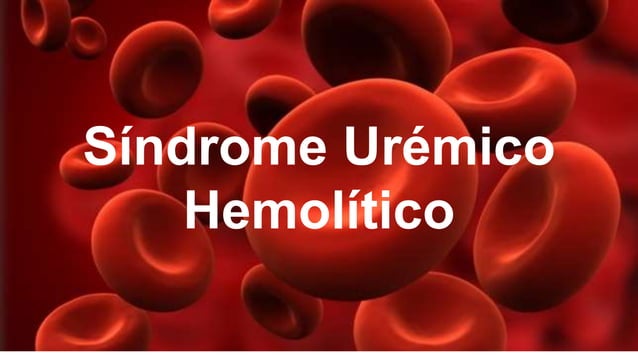 Anemia hemolítica microangiopática