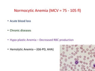 Normocytic Anemia (MCV = 75 - 105 fl)
• Acute blood loss
• Chronic diseases
• Hypo-plastic Anemia – Decreased RBC production
• Hemolytic Anemia – (G6-PD, AHA)
 