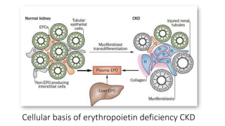 Cellular basis of erythropoietin deficiency CKD
 