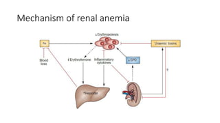 Mechanism of renal anemia
 