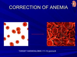 CORRECTION OF ANEMIACORRECTION OF ANEMIA
TARGET HAEMOGLOBIN =11-12 grams/dl
 