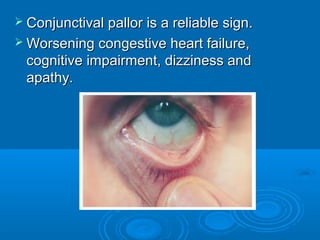  Conjunctival pallor is a reliable sign.Conjunctival pallor is a reliable sign.
 Worsening congestive heart failure,Worsening congestive heart failure,
cognitive impairment, dizziness andcognitive impairment, dizziness and
apathy.apathy.
 