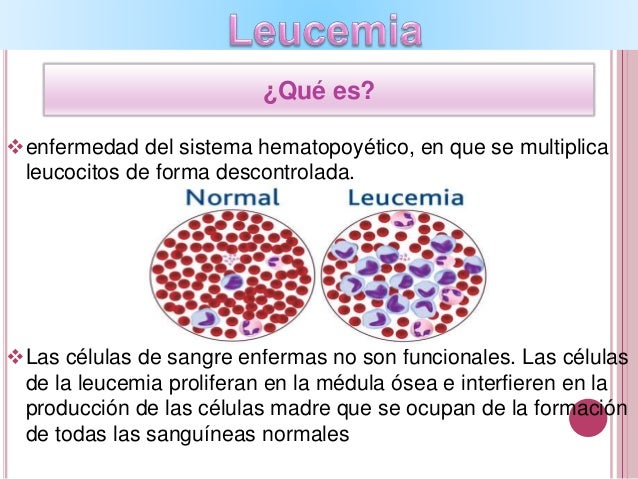 Anemia, leucemia, linfoma...