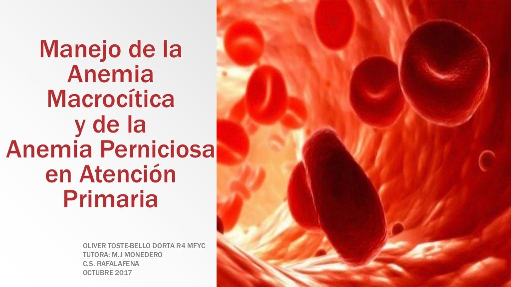 Anemia macrocitica y anemia perniciosa