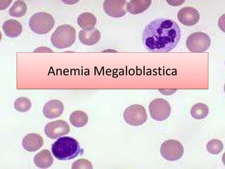 Anemia Megaloblastica 