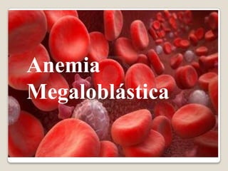 Anemia
Megaloblástica

 