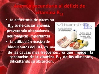 Anemia secundaria al déficit de
vitamina B12
• La deficiencia de vitamina
B12 suele causar anemia,
provocando alteraciones...