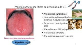 15
Manifestações específicas da deficiência de B12
• Alterações neurológicas:
• (Desmielinização cordões laterais
e dorsais medula espinal):
• Parestesias (formigueiros mão e
pés)
• Alteração sensibilidade postural
• Alterações da marcha
• Alterações do comportamento
Hiperémia lingual
 