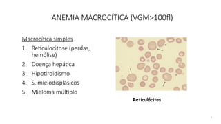5
ANEMIA MACROCÍTICA (VGM>100fl)
Macrocítica simples
1. Reticulocitose (perdas,
hemólise)
2. Doença hepática
3. Hipotiroidismo
4. S. mielodisplásicos
5. Mieloma múltiplo
Reticulócitos
 