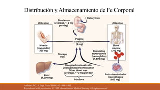 Distribución y Almacenamiento de Fe Corporal
Andrews NC. N Engl J Med 1999;341:1986–1995
Reproduced with permission. © 1999 Massachusetts Medical Society. All rights reserved
Dietary iron
Utilization Utilization
Duodenum
(average, 1–2 mg
per day)
Muscle
(myoglobin)
(300 mg)
Liver
(1,000 mg)
Bone
marrow
(300 mg)Circulating
erythrocytes
(hemoglobin)
(1,800 mg)
Reticuloendothelial
macrophages
(600 mg)
Sloughed mucosal cells
Desquamation/Menstruation
Other blood loss
(average, 1–2 mg per day)
Storage
iron
Plasma
transferrin
(3 mg)
Iron loss
 