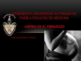 BENEMÉRITA UNIVERSIDAD AUTÓNOMA DE
PUEBLA FACULTAD DE MEDICINA
ANEMIA EN EL EMBARAZO
SANCHEZ VALENCIA T. MIGUEL

 