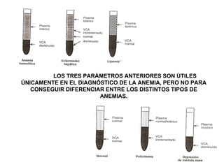 LOS TRES PARÁMETROS ANTERIORES SON ÚTILES
ÚNICAMENTE EN EL DIAGNÓSTICO DE LA ANEMIA, PERO NO PARA
CONSEGUIR DIFERENCIAR ENTRE LOS DISTINTOS TIPOS DE
ANEMIAS.
 