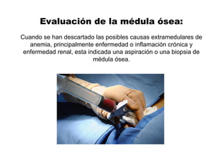 Evaluación de la médula ósea:
Cuando se han descartado las posibles causas extramedulares de
anemia, principalmente enfermedad o inflamación crónica y
enfermedad renal, esta indicada una aspiración o una biopsia de
médula ósea.
 