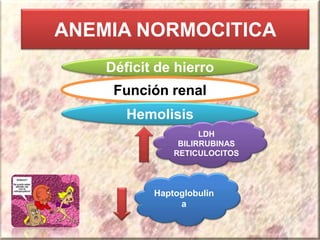 ANEMIA NORMOCITICA
Déficit de hierro
Función renal
Hemolisis
LDH
BILIRRUBINAS
RETICULOCITOS
Haptoglobulin
a
 