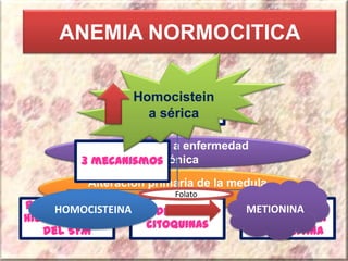 ANEMIA NORMOCITICA
Secundaria a enfermedad
crónica
Alteración primaria de la medula
ósea
Hemoglobina
baja
Retención del
hierro dentro
del SFM
Mediado por
citoquinas
Respuesta
inadecuada a
la ferritina
3 mecanismos
Homocistein
a sérica
HOMOCISTEINA METIONINA
Folato
 
