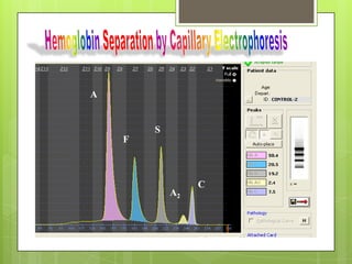 A


        S
    F



                 C
            A2
 