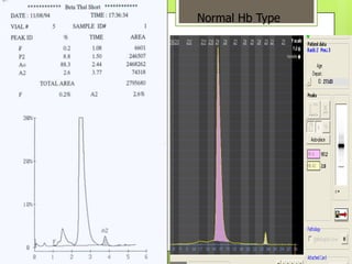 Normal Hb Type
 