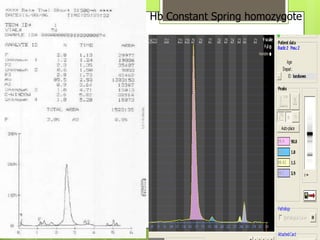 Hb Constant Spring homozygote
 