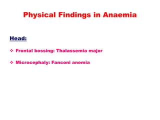 Head:
 Frontal bossing: Thalassemia major
 Microcephaly: Fanconi anemia
Physical Findings in Anaemia
 