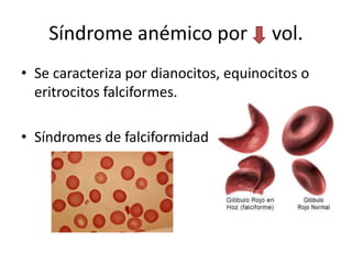 Anemia pediatrica