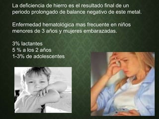 La deficiencia de hierro es el resultado final de un
periodo prolongado de balance negativo de este metal.
Enfermedad hematológica mas frecuente en niños
menores de 3 años y mujeres embarazadas.
3% lactantes
5 % a los 2 años
1-3% de adolescentes
 