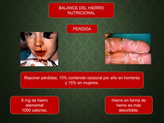 BALANCE DEL HIERRO
NUTRICIONAL
PERDIDA
Reponer pérdidas; 10% contenido corporal por año en hombres
y 15% en mujeres.
6 mg de hierro
elemental
1000 calorías.
Hierro en forma de
hemo es más
absorbible.
 