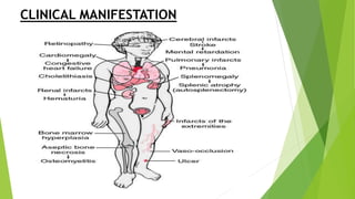 CLINICAL MANIFESTATION
 