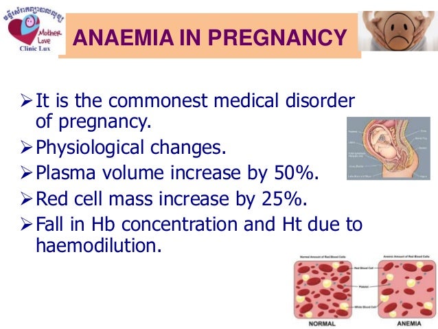 Anemia pregnancy