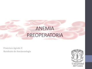 ANEMIA
PREOPERATORIA
Francisco Agredo V.
Residente de Anestesiología
 